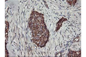 Immunohistochemistry (IHC) image for anti-TNF Receptor-Associated Protein 1 (TRAP1) antibody (ABIN1501499) (TRAP1 anticorps)