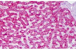 Anti-ACAT1 antibody IHC staining of human liver, hepatocytes. (ACAT1 anticorps  (AA 221-270))