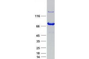 Validation with Western Blot