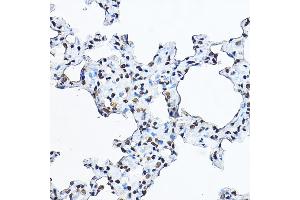 Immunohistochemistry of paraffin-embedded rat lung using Histone H3 Rabbit pAb (ABIN3023242, ABIN3023243, ABIN3023244, ABIN1513010 and ABIN6219504) at dilution of 1:100 (40x lens). (Histone 3 anticorps  (C-Term))