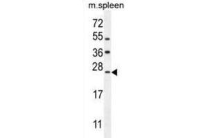 Western Blotting (WB) image for anti-LIM Domain Only 4 (LMO4) antibody (ABIN2995822) (LMO4 anticorps)