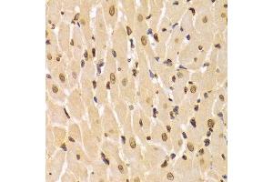 Immunohistochemistry of paraffin-embedded Rat heart using Lamin A/C antibody.