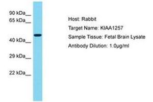Image no. 1 for anti-Cilia and Flagella Associated Protein 92 (CFAP92) (AA 314-363) antibody (ABIN6750571) (CFAP92/KIAA1257 anticorps  (AA 314-363))