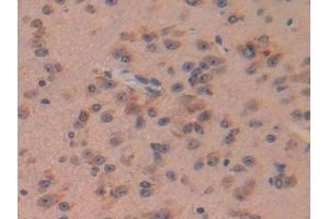 IHC-P analysis of Mouse Brain Tissue, with DAB staining.
