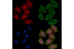 Phospho-Optineurin (Ser177) Antibody staining Hela cells(45 min of heat-shock treatment) by IF/ICC. (OPTN anticorps  (pSer177))