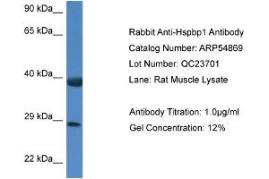 Western Blotting (WB) image for anti-HSPA Binding Protein, Cytoplasmic Cochaperone 1 (HSPBP1) (C-Term) antibody (ABIN2785930) (HSPBP1 anticorps  (C-Term))