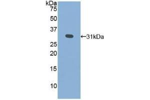 Detection of Recombinant GLa, Human using Polyclonal Antibody to Galactosidase Alpha (GLa) (GLA anticorps  (AA 147-371))