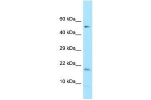 WB Suggested Anti-DAZAP2 Antibody Titration: 1. (DAZAP2 anticorps  (C-Term))