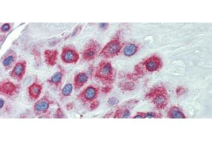 Immunohistochemistry with Human Placenta lysate tissue at an antibody concentration of 5.
