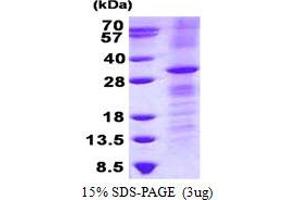Image no. 1 for Ras Homolog Gene Family, Member V (RHOV) protein (His tag) (ABIN1098671) (RHOV Protein (His tag))