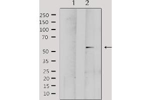 Western blot analysis of lysates from Hela, using MMP1 Antibody.