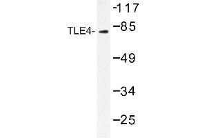 Image no. 1 for anti-Transducin-like Enhancer Protein 4 (TLE4) antibody (ABIN272213) (TLE4 anticorps)