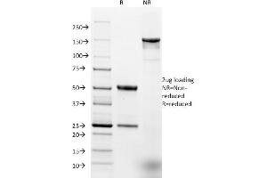 SDS-PAGE Analysis Purified EpCAM Mouse Monoclonal Antibody (EGP40/1384). (EpCAM anticorps  (Extracellular Domain))