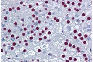 Human Adrenal: Formalin-Fixed, Paraffin-Embedded (FFPE)