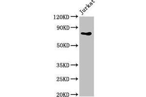 Western Blot Positive WB detected in: Jurkat whole cell lysate All lanes: PIK3R2 antibody at 4 μg/mL Secondary Goat polyclonal to rabbit IgG at 1/50000 dilution Predicted band size: 82 kDa Observed band size: 82 kDa (PIK3R2 anticorps  (Regulatory Subunit beta))