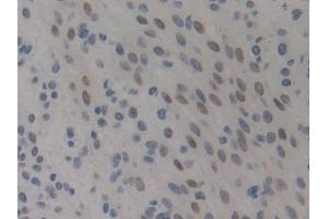 Detection of HMGN1 in Mouse Uterus Tissue using Polyclonal Antibody to High Mobility Group Nucleosome Binding Domain Protein 1 (HMGN1)