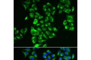 Immunofluorescence analysis of A549 cells using GLUD2 Polyclonal Antibody
