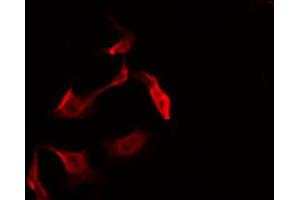 ABIN6266462 staining 293 by IF/ICC.