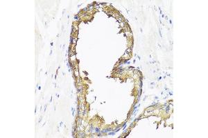 Immunohistochemistry of paraffin-embedded human prostate using SMAD2 antibody (ABIN4905224) at dilution of 1:100 (40x lens). (SMAD2 anticorps)