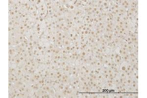Immunoperoxidase of monoclonal antibody to LHX4 on formalin-fixed paraffin-embedded human adrenal gland.