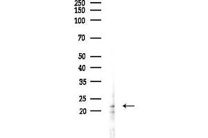 anti-Dual Specificity Phosphatase 14 (DUSP14) antibody