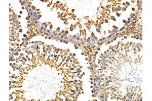 ABIN6259032 and ABIN6275010 at 1/100 staining Rat testis tissue by IHC-P. (CHSY1 anticorps  (Internal Region))