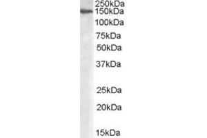Western Blotting (WB) image for anti-MAN2A1 / Mannosidase II (AA 881-891) antibody (ABIN291737) (MAN2A1 / Mannosidase II (AA 881-891) anticorps)