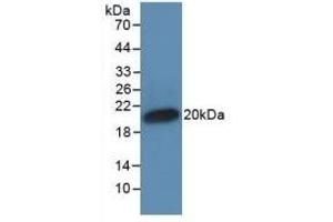 Detection of Recombinant IFNa, Human using Monoclonal Antibody to Interferon Alpha (IFNa) (IFNA anticorps  (AA 24-181))