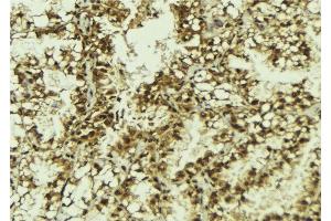 ABIN6279859 at 1/100 staining Human lung tissue by IHC-P. (SFRS9 anticorps  (Internal Region))