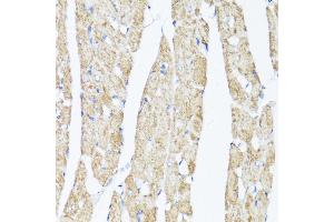 Immunohistochemistry of paraffin-embedded Rat heart using XBP1s antibody (ABIN7271399) at dilution of 1:100 (40x lens). (XBP1 anticorps  (AA 300-376))