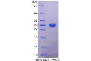 SDS-PAGE analysis of Human Aconitase 1 Protein. (Aconitase 1 Protein (ACO1))