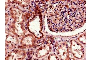 Immunohistochemistry of paraffin-embedded human kidney tissue using ABIN7172838 at dilution of 1:100 (TGFBRAP1 anticorps  (AA 401-600))