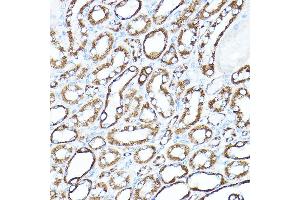 Immunohistochemistry of paraffin-embedded mouse kidney using HK1 Rabbit pAb (ABIN3021308, ABIN3021309, ABIN3021310 and ABIN6214823) at dilution of 1:150 (40x lens).