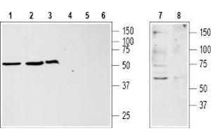 Western blot analysis of Jurkat (lanes 1 and 4), HL-60 (lanes 2 and 5), MCF-7 (lanes 3 and 6) and rat brain (lanes 7 and 8) lysates: - 1,2,3,7. (KISS1R anticorps  (3rd Extracellular Loop))