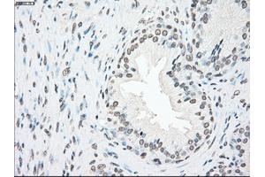 Immunohistochemical staining of paraffin-embedded Ovary tissue using anti-PLK1mouse monoclonal antibody. (PLK1 anticorps)