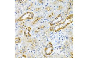 Immunohistochemistry of paraffin-embedded rat kidney using  antibody (ABIN6129960, ABIN6136680, ABIN6136681 and ABIN6224707) at dilution of 1:100 (40x lens). (AIFM3 anticorps  (AA 1-200))