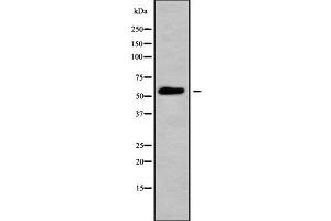 Western blot analysis of MOT6 using HepG2 whole cell lysates (SLC16A5 anticorps  (Internal Region))