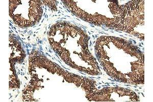 Immunohistochemical staining of paraffin-embedded Human liver tissue using anti-EPHX2 mouse monoclonal antibody. (EPHX2 anticorps)