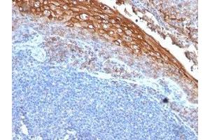 Formalin-fixed, paraffin-embedded human tonsil stained with CD146 antibody (MUC18/1130) (MCAM anticorps)