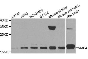 Western blot analysis of extracts of various cell lines, using NME4 antibody. (NME4 anticorps  (AA 1-187))
