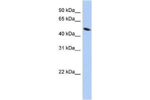WB Suggested Anti-ZNF793 Antibody Titration:  0. (ZNF793 anticorps  (Middle Region))