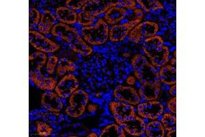 Immunofluorescence of paraffin embedded rat kidney using NRP2 (ABIN7074826) at dilution of 1: 650 (300x lens)