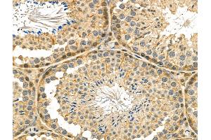 ABIN6260917 and ABIN6278560 at 1/100 staining Mouse testis tissue by IHC-P. (CNR2 anticorps  (C-Term))