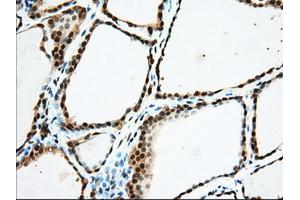 Immunohistochemical staining of paraffin-embedded Human Kidney tissue using anti-USP5 mouse monoclonal antibody. (USP5 anticorps)