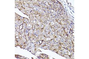 Immunohistochemistry of paraffin-embedded human liver using [KO Validated] CD73/NT5E Rabbit pAb (ABIN3022733, ABIN3022734, ABIN3022735, ABIN1513283 and ABIN6219201) at dilution of 1:50 (40x lens).