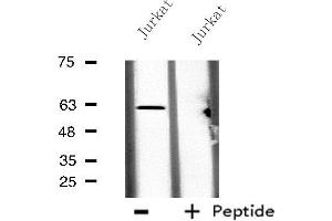 Western blot analysis of extracts from Jurkat cells, using CES2 antibody. (CES2 anticorps  (N-Term))