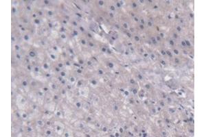 Detection of UCP2 in Human Liver Tissue using Monoclonal Antibody to Mitochondrial Uncoupling Protein 2 (UCP2)