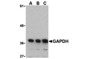 Western Blotting (WB) image for anti-Glyceraldehyde-3-Phosphate Dehydrogenase (GAPDH) (N-Term) antibody (ABIN1031391) (GAPDH anticorps  (N-Term))