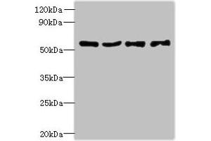 Western blot All lanes: UBA5 antibody at 6 μg/mL Lane 1: Jurkat whole cell lysate Lane 2: Hela whole cell lysate Lane 3: HepG2 whole cell lysate Lane 4: Caco-2 whole cell lysate Secondary Goat polyclonal to rabbit IgG at 1/10000 dilution Predicted band size: 45, 39 kDa Observed band size: 45 kDa (UBA5 anticorps  (AA 291-404))