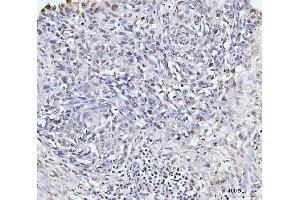 IHC analysis of KIFC1 using anti-KIFC1 antibody (ABIN7599523). (KIFC1 anticorps  (AA 1-673))